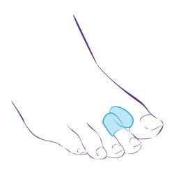 СТ-54.3 Межпальцевая перегородка с кольцом