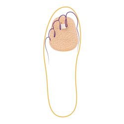 СТ-221 Корректор 1 пальца